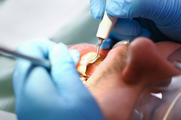 Best Broken or Cracked Tooth Emergency Dentist in White Oak, TX