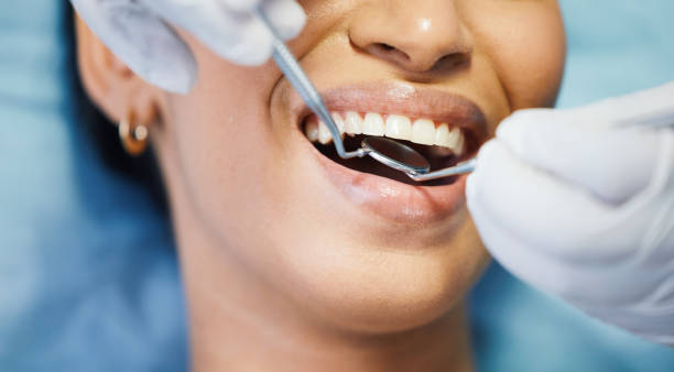 Best Holiday Emergency Dentist in White Oak, TX